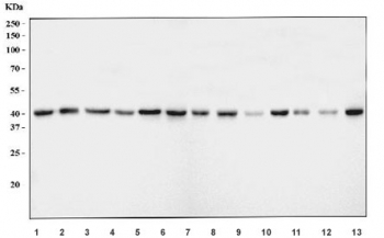 Western blot testing of 1) human A549, 2) human Daudi, 3) human HepG2, 4) human Caco-2, 5) human MOLT4, 6) human Jurkat, 7) rat testis, 8) rat brain, 9) rat kidney, 10) rat C6, 11) mouse brain, 12) mouse kidney and 13) mouse NIH 3T3 cell lysate with AHSA1 antibody. Predicted molecular weight ~38 kDa.