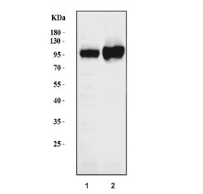 Western blot testing of human 1) Ramos and 2) Raji cell lysate with ICAM1 antibody. Predicted molecular weight: ~58 kDa (unmodified), 75-115 kDa (glycosylated).