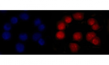 MSH2 Antibody Mouse Monoclonal 6B4F7. Immunofluorescence analysis of FFPE human Caco-2 cells shows strong nuclear staining corresponding to MutS homolog 2 (MSH2) protein localization. Red fluorescent signal highlights MSH2-positive nuclei throughout the cell population, while DAPI counterstain (blue) marks total nuclear DNA for reference. The staining pattern demonstrates clear nuclear accumulation consistent with the role of MSH2 as a DNA mismatch repair protein functioning within the nucleus. Heat-induced epitope retrieval was performed by steaming sections in pH6 citrate buffer for 20 minutes prior to antibody incubation.