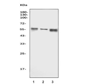 Western blot testing of human 1) Jurkat, 2) Ramos and 3) HL60 cell lysate with TOX antibody. Predicted molecular weight ~57 kDa.