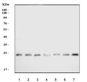 Western blot testing of 1) rat brain, 2) rat liver, 3) rat kidney, 4) rat pancreas, 5) mouse brain, 6) mouse liver and 7) mouse kidney tissue cell lysate with Proteasome 20S beta 7 antibody. Predicted molecular weight ~30 kDa.