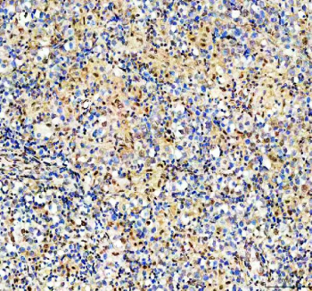 IHC staining of FFPE human testis tissue with RAD50 antibody, HRP-secondary and DAB substrate. HIER: boil tissue sections in pH8 EDTA for 20 min and allow to cool before testing.