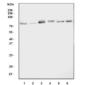 Western blot testing of 1) human HepG2, 2) human MCF7, 3) rat brain, 4) rat testis, 5) mouse brain and 6) mouse testis lysate with Solo antibody. Predicted molecular weight ~79 kDa.