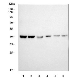 Western blot testing of 1) human T-47D, 2) HL60, 3) A549, 4) HepG2, 5) rat brain and 6) mouse brain tissue lysate with Poly(rC)-binding protein 2 antibody. Predicted molecular weight ~39 kDa.