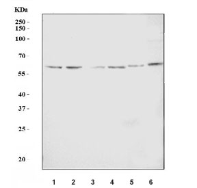 Western blot testing of 1) human 293T, 2) human HeLa, 3) human Jurkat, 4) human MCF7, 5) rat PC-12 and 6) mouse NIH 3T3 cell lysate with CENPI antibody. Predicted molecular weight: ~87 kDa (isoform 1) and ~60 kDa (isoform 2).