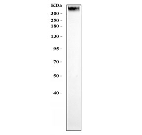 Western blot testing of human U-2 OS cells with p53 binding protein 1 antibody. Predicted molecular weight: ~214 kDa but may be observed at up to ~450 kDa.