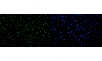 Immunofluorescent staining of FFPE human HeLa cells with p53 binding protein 1 antibody (green) and DAPI nuclear stain (blue). HIER: steam section in pH6 citrate buffer for 20 min.