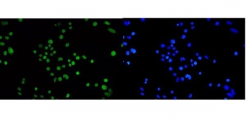 Immunofluorescent staining of FFPE human SiHa cells with TPR antibody (green) and DAPI nuclear stain (blue). HIER: steam section in pH6 citrate buffer for 20 min.