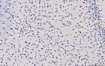 IHC staining of FFPE rat brain tissue with TPR antibody. HIER: boil tissue sections in pH8 EDTA for 20 min and allow to cool before testing.
