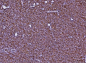 IHC staining of FFPE rat lymph node tissue with Cxcr3 antibody. HIER: boil tissue sections in pH8 EDTA for 20 min and allow to cool before testing.