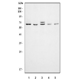 Western blot testing of huma 1) Jurkat, 2) CCRF-CEM, 3) 293T, 4) HeLa and 5) MCF7 cell lysate with KAT5 antibody. Predicted molecular weight ~59 kDa.