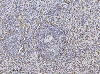 SLC4A1 Antibody Human Spleen IHC. Immunohistochemical staining of FFPE human spleen tissue using SLC4A1 Antibody / Erythrocyte Membrane Protein Antibody demonstrates widespread membranous and cytoplasmic HRP-DAB brown staining within erythrocyte-rich cellular populations distributed throughout splenic tissue. SLC4A1 (AE1/Band 3) is a chloride/bicarbonate exchanger that plays a critical role in erythrocyte membrane function, carbon dioxide transport, and maintenance of acid-base homeostasis. As one of the most abundant membrane proteins in red blood cells, SLC4A1 contributes to membrane organization, structural stability, and physiologic ion transport. The observed staining pattern is consistent with the established role of SLC4A1 in erythroid cell biology and blood-associated tissues. HIER: boil tissue sections in pH 8 EDTA for 20 minutes and allow to cool before testing.