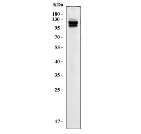 SLC4A1 Antibody K562 WB. Western blot analysis of human K562 cell lysate using SLC4A1 Antibody / Erythrocyte Membrane Protein Antibody demonstrates a prominent band at approximately 100-110 kDa, consistent with expression of SLC4A1 (AE1/Band 3). SLC4A1 is a chloride/bicarbonate exchanger that plays an essential role in erythrocyte membrane physiology, carbon dioxide transport, and maintenance of cellular ionic balance. The observed molecular weight is consistent with the expected size of SLC4A1 and may be influenced by glycosylation, which is known to affect electrophoretic migration of the mature protein. Detection in K562 cells is consistent with the hematopoietic lineage-associated biology of SLC4A1 and its role in erythroid differentiation and membrane transport pathways.