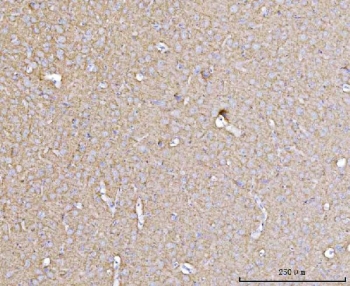 DBN1 Synaptic Plasticity Marker Antibody Rat Brain IHC. Immunohistochemistry analysis of FFPE rat brain tissue using DBN1 antibody (clone 4F6E7) shows diffuse cytoplasmic staining in neuronal cells with fine granular signal in the neuropil, consistent with DBN1 / Drebrin localization in dendritic processes and synaptic regions. The staining pattern highlights actin-rich compartments associated with dendritic spine structure and synaptic plasticity, while non-neuronal regions display comparatively lower signal. Hematoxylin counterstain provides nuclear contrast and tissue context. HIER: boil FFPE tissue sections in pH 8 EDTA for 20 min and allow to cool before testing.