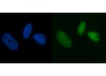 MCM7 Antibody PC-3 Cell IF. Immunofluorescent staining of FFPE human PC-3 cells with MCM7 antibody (green) and DAPI nuclear stain (blue). HIER: steam section in pH6 citrate buffer for 20 min.