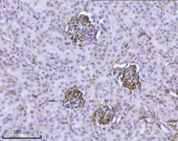 IHC staining of FFPE mouse kidney tissue with Integrin linked ILK antibody. HIER: boil tissue sections in pH8 EDTA for 20 min and allow to cool before testing.