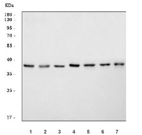 Western blot testing of 1) human SiHa, 2) human HaCaT, 3) human A549, 4) rat brain, 5) rat lung, 6) mouse brain and 7) mouse lung tissue lysate with Alpha/beta-hydrolase 4 antibody. Predicted molecular weight ~39 kDa.