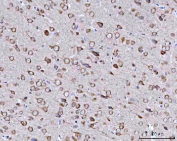 IHC staining of FFPE rat brain tissue with BBS9 antibody. HIER: boil tissue sections in pH8 EDTA for 20 min and allow to cool before testing.