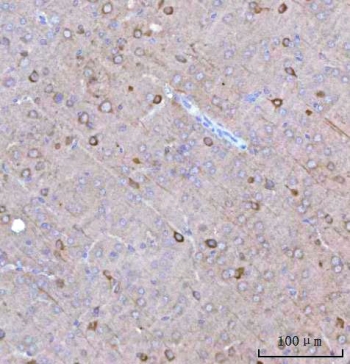 IHC staining of FFPE rat brain tissue with BCAT1 antibody. HIER: boil tissue sections in pH8 EDTA for 20 min and allow to cool before testing.