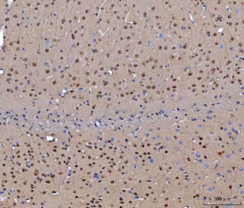IHC staining of FFPE mouse brain tissue with CEP250 antibody. HIER: boil tissue sections in pH8 EDTA for 20 min and allow to cool before testing.