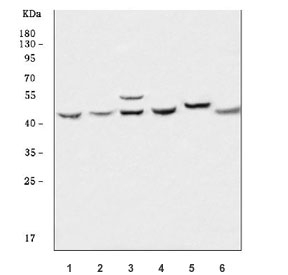Western blot testing of 1) human Raji, 2) human MOLT4, 3) human HeLa, 4) rat brain, 5) mouse brain and 6) mouse lung tissue lysate with MDR15 antibody. Predicted molecular weight ~43 kDa.