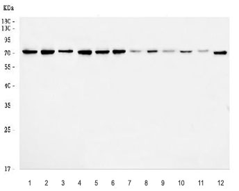 Western blot testing of 1) human HeLa, 2) human HepG2, 3) human K562, 4) human Caco-2, 5) human SiHa, 6) human RT4, 7) rat brain, 8) rat heart, 9) rat testis, 10) rat C6, 11) mouse brain and 12) mouse NIH 3T3 cell lysate with Embryonic ectoderm development protein antibody. Expected molecular weight: 30~65 kDa (multiple isoforms).