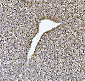 IHC staining of FFPE rat liver tissue with Fumarylacetoacetate hydrolase antibody. HIER: boil tissue sections in pH8 EDTA for 20 min and allow to cool before testing.