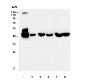 Western blot testing of 1) human HCCP, 2) human HepG2, 3) rat liver, 4) rat kidney, 5) mouse liver and 6) mouse kidney tissue lysate with Fumarylacetoacetate hydrolase antibody. Predicted molecular weight: 39-46 kDa (two isoforms).
