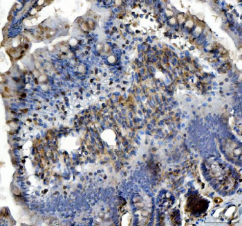 IHC staining of FFPE rat colon tissue with Insulin receptor substrate 2 antibody. HIER: boil tissue sections in pH8 EDTA for 20 min and allow to cool before testing.