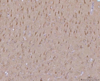 IHC staining of FFPE rat brain tissue with Mitochondrial fission factor antibody. HIER: boil tissue sections in pH8 EDTA for 20 min and allow to cool before testing.