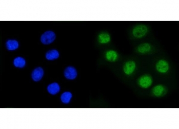 RAD21 Antibody Human Cancer Cell IF. Immunofluorescent staining of FFPE human SiHa cells using RAD21 Antibody (green) with DAPI nuclear counterstain (blue). HIER was performed by steaming sections in pH 6 citrate buffer for 20 minutes prior to staining. RAD21 Antibody, a Cohesin Complex Protein Antibody, demonstrates strong nuclear localization in SiHa cells, consistent with the role of RAD21 in the cohesin complex, chromosome organization, sister chromatid cohesion, and regulation of genome stability.
