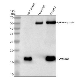 Immunoprecipitation of TOMM20 protein from 500ug of human HepG2 whole cell lysate with 2ug of TOMM20 antibody.