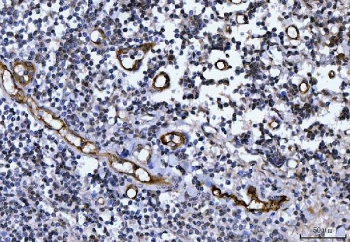 von Willebrand Factor Antibody / Hemostasis Research Antibody. Immunohistochemistry analysis of human tonsil tissue shows HRP-DAB brown staining of endothelial cells lining vascular channels within lymphoid tissue. The staining outlines elongated and branching vessel structures, with signal localized along the endothelial surface consistent with VWF presence at the vascular interface. This pattern reflects vessel-associated regions where VWF contributes to platelet adhesion and coagulation factor support in hemostatic processes. Endothelial-lined vessels are clearly distinguished from surrounding lymphoid cells and stromal components. HIER: boil tissue sections in pH8 EDTA for 20 min and allow to cool before testing.