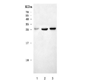 Western blot testing of 1) human PCP, 2) rat pancreas and 3) mouse pancreas tissue lysate with CTRL antibody. Predicted molecular weight ~28 kDa.