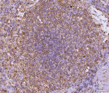 CD135 Antibody Spleen IHC. Immunohistochemistry analysis of FFPE human spleen tissue stained with CD135 antibody. Distinct membranous and cytoplasmic HRP-DAB brown staining is observed within lymphoid cell populations, consistent with the expected expression profile of Fms-like tyrosine kinase 3 / FLT3/CD135, a class III receptor tyrosine kinase involved in hematopoietic progenitor regulation, cytokine-responsive signaling, and immune-associated cellular development pathways. Tissue sections underwent HIER using pH 8 EDTA buffer prior to immunostaining.