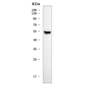 Western blot testing of human Daudi cell lysate with HAVCR2 antibody. Expected molecular weight: 33-70 kDa depending on glycosylation level.