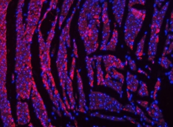 Immunofluorescent staining of FFPE rat heart tissue with NDUFS2 antibody (red) and DAPI nuclear stain (blue). HIER: steam section in pH8 EDTA buffer for 20 min.
