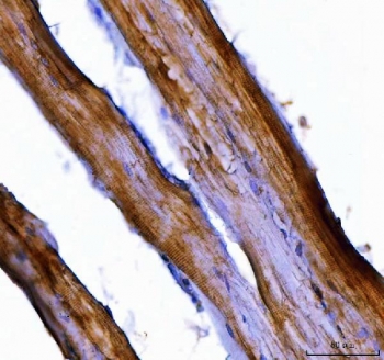 NEDD4 Antibody Mouse Muscle Tissue IHC. Immunohistochemistry staining of FFPE mouse skeletal muscle tissue with NEDD4 antibody. HIER: boil tissue sections in pH8 EDTA for 20 min and allow to cool before testing.