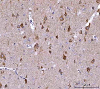 NEDD4 Antibody Rat Brain Tissue IHC Neuronal Distribution Pattern. Immunohistochemistry analysis of Neural precursor cell expressed developmentally down-regulated protein 4 / NEDD4 in FFPE rat brain tissue using NEDD4 Antibody for IHC. Brown HRP-DAB staining highlights scattered neuronal populations with distinct cell body labeling and minimal staining in non-neuronal regions, consistent with NEDD4 expression in neural tissue. HIER: boil tissue sections in pH8 EDTA for 20 min and allow to cool before testing.