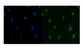 Immunofluorescent staining of FFPE human A549 cells with TIP49A antibody (green) and DAPI nuclear stain (blue). HIER: steam section in pH6 citrate buffer for 20 min.