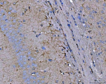 IHC staining of FFPE mouse brain tissue with Septin 2 antibody. HIER: boil tissue sections in pH8 EDTA for 20 min and allow to cool before testing.