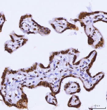 IHC staining of FFPE human placental tissue with TARBP2 antibody. HIER: boil tissue sections in pH8 EDTA for 20 min and allow to cool before testing.