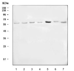 Western blot testing of human 1) A549, 2) HepG2, 3) HeLa, 4) Caco-2, 5) MOLT4, 6) SH-SY5Y and 7) U-251 cell lysate with USP22 antibody. Predicted molecular weight ~60 kDa.