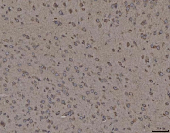 IHC staining of FFPE mouse brain tissue with CANX antibody. HIER: boil tissue sections in pH8 EDTA for 20 min and allow to cool before testing.