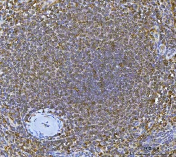 IRF7 Antibody Human Spleen IHC. Immunohistochemistry staining of FFPE human spleen tissue using IRF7 Antibody / Antiviral Response Protein Antibody demonstrates widespread nuclear and cytoplasmic HRP-DAB brown staining throughout splenic lymphoid cell populations. Strong immunoreactivity is observed within cells populating the white pulp, consistent with expression of Interferon Regulatory Factor 7 (IRF7), a transcription factor that serves as a master regulator of type I interferon production and antiviral immune responses. The staining pattern aligns with the established role of IRF7 in innate immune activation, host defense signaling, and regulation of interferon-dependent gene expression within lymphoid tissues. HIER: boil tissue sections in pH 8 EDTA for 20 minutes and allow to cool before testing.
