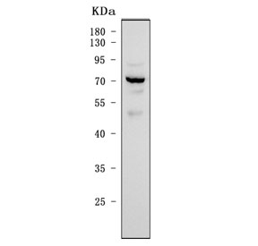 IRF7 Antibody Human 293T Cell WB. Western blot analysis of human 293T cell lysate using IRF7 Antibody / Antiviral Response Protein Antibody demonstrates a prominent immunoreactive band at approximately 65-70 kDa. The observed molecular weight is higher than the predicted size of Interferon Regulatory Factor 7 (IRF7) (~54 kDa), which is consistent with phosphorylation and other post-translational modifications known to regulate IRF7 activation, dimerization, and nuclear translocation during antiviral signaling. IRF7 functions as a master regulator of type I interferon production and innate immune responses, controlling expression of genes involved in host defense against viral infection. The strong band observed in 293T cells is consistent with expression of IRF7 and its modified forms associated with immune signaling pathways.