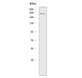 DNA methyltransferase 1 Antibody Mouse Testis WB. Western blot testing of mouse testis tissue lysate with DNA methyltransferase 1 antibody. Predicted molecular weight: 180-200 kDa.