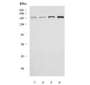 Western blot testing of 1) human 293T, 2) human HepG2, 3) human HeLa and 4) rat PC-12 cell lysate with Niemann Pick C1 antibody. Predicted molecular weight ~142/170~190 kDa (unmodified/glycosylated).