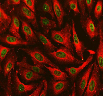 Immunofluorescent staining of FFPE human U-2 OS cells with EXO1 antibody (green) and Alpha Tubulin mAb (red). HIER: steam section in pH6 citrate buffer for 20 min.