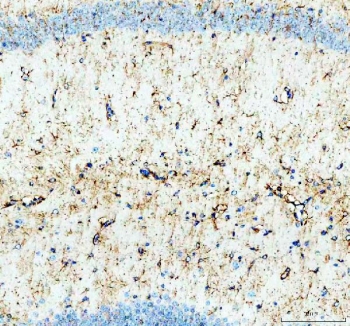 IHC staining of FFPE mouse brain tissue with Glycogen synthase kinase-3 beta antibody. HIER: boil tissue sections in pH8 EDTA for 20 min and allow to cool before testing.